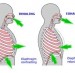 Breathing and Neck and Back Pain